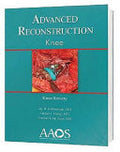Advanced Reconstruction Knee
