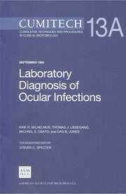 Laboratory diagnosis of ocular infections